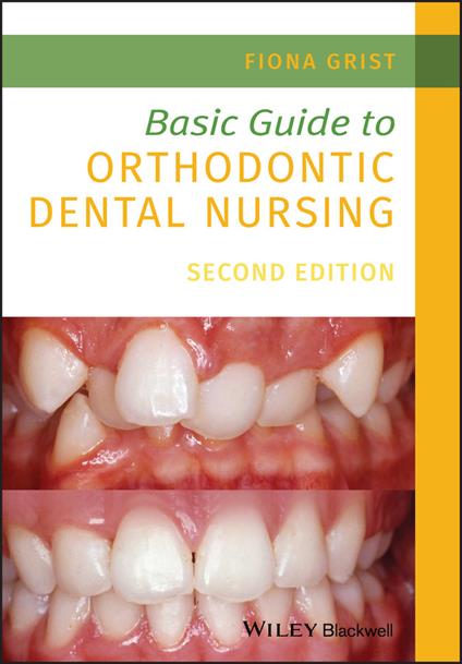Basic Guide to Orthodontic Dental Nursing - Fiona Grist - cover