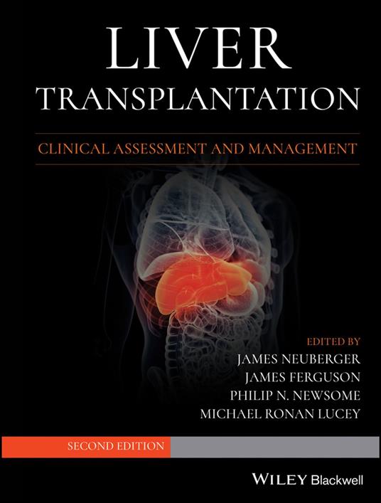Liver Transplantation