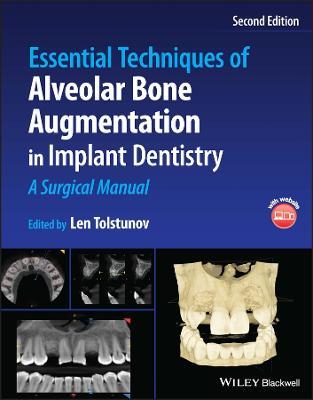 Essential Techniques of Alveolar Bone Augmentation in Implant Dentistry: A Surgical Manual - cover