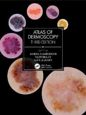 Atlas of Dermoscopy: Third Edition - Ashfaq A Marghoob,Ralph Braun,Natalia Jaimes - cover