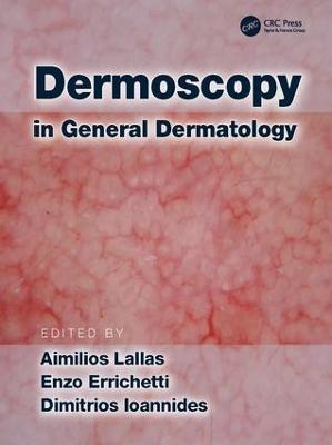 Dermoscopy in General Dermatology - cover