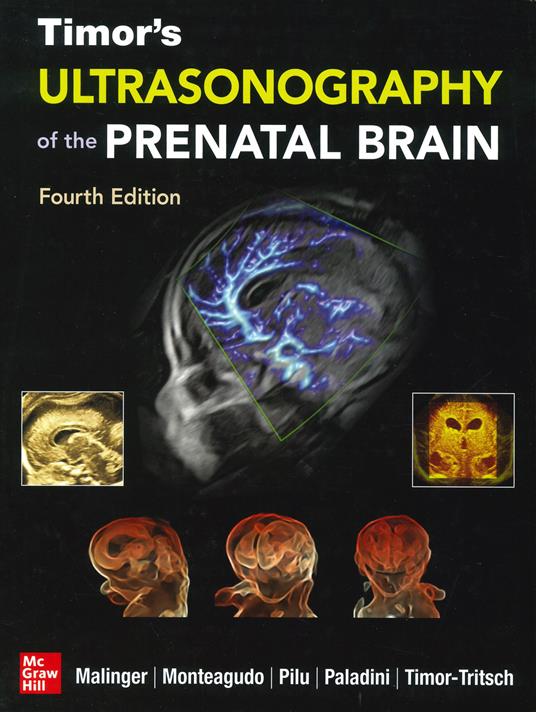 Ultrasonography of the prenatal brain. Nuova ediz. - Gustavo Malinger,Ana Monteagudo,Gianluigi Pilu - copertina