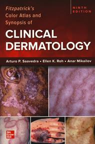 Fitzpatrick's color atlas and synopsis of clinical dermatology
