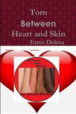 Torn between Heart and Skin - Ernst Delma - cover