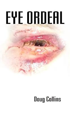Eye Ordeal - Doug Collins - cover