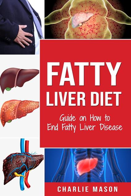 Fatty Liver Diet: Guide on How to End Fatty Liver Disease