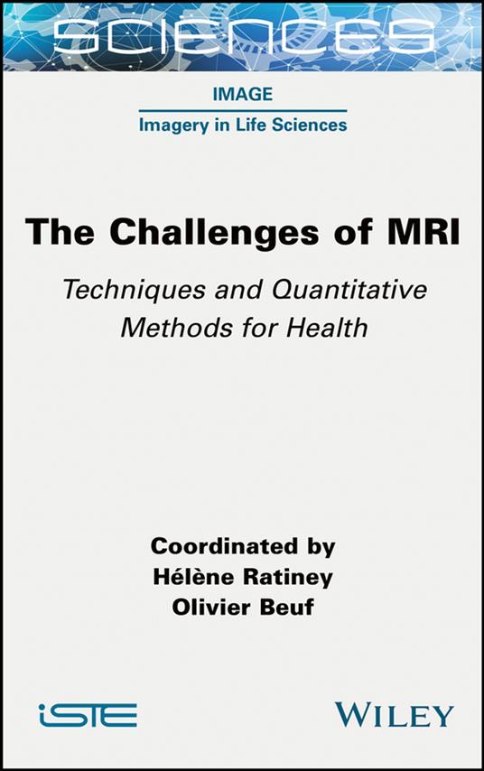 The Challenges of MRI