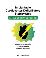 Implantable Cardioverter - Defibrillators Step by Step: An Illustrated Guide