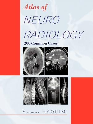 Atlas Of NEURORADIOLOGY: 200 Common Cases - AMMAR HAOUIMI - cover