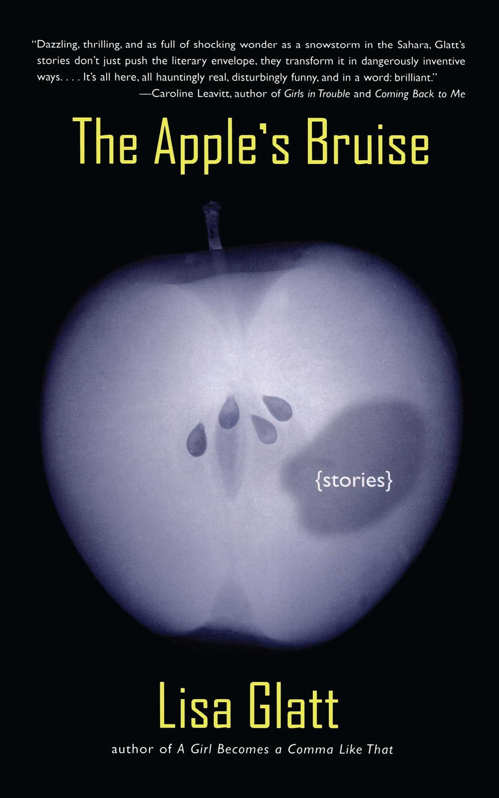 ibs