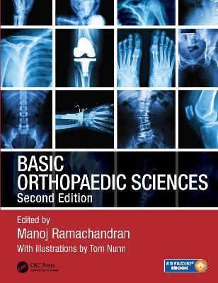 Basic Orthopaedic Sciences - cover
