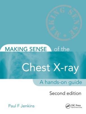 Making Sense of the Chest X-ray: A hands-on guide - Paul Jenkins - cover