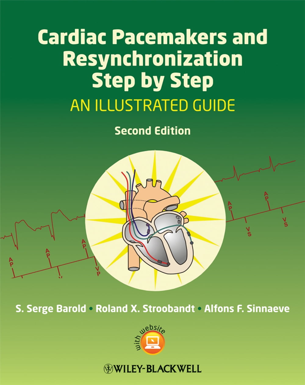 Simplified Interpretation of Pacemaker ECGs [ペーパーバック] Hesselson， Aaron B. Simplified Interpretation of Pacemaker ECGs by Aaron