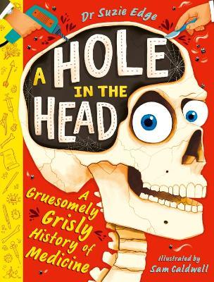 A Hole in the Head: A gruesomely grisly history of medical firsts - Suzie Edge - cover
