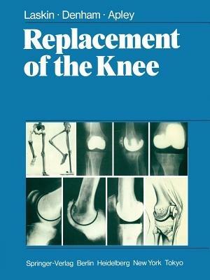 Replacement of the Knee - R.S. Laskin,R.A. Denham,A.G. Apley - cover
