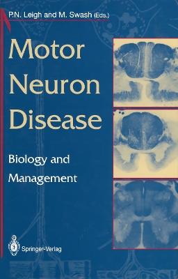 Motor Neuron Disease: Biology and Management - cover