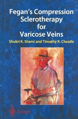 Fegan’s Compression Sclerotherapy for Varicose Veins - cover