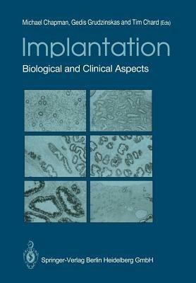 Implantation: Biological and Clinical Aspects - cover