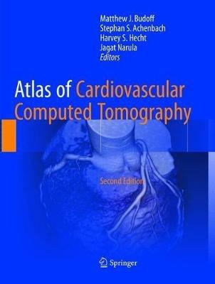 Atlas of Cardiovascular Computed Tomography - cover