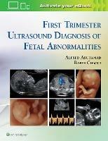 First Trimester Ultrasound Diagnosis of Fetal Abnormalities - Alfred Z. Abuhamad,Rabih Chaoui - cover