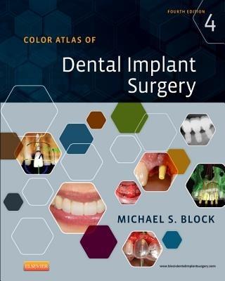 Color Atlas of Dental Implant Surgery - Michael S. Block - cover