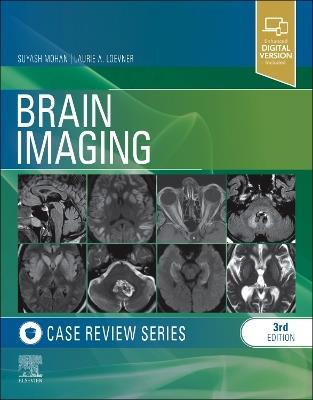 Brain Imaging: Case Review Series - Suyash Mohan,Laurie A. Loevner - cover