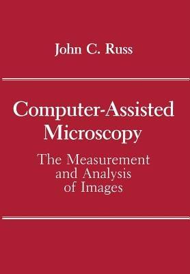 Computer-Assisted Microscopy: The Measurement and Analysis of Images - John C. Russ - cover