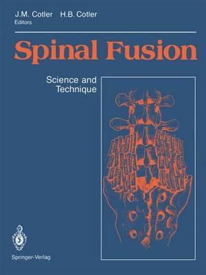 Spinal Fusion: Science and Technique - cover