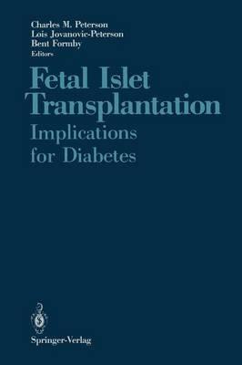 Fetal Islet Transplantation: Implications for Diabetes - cover