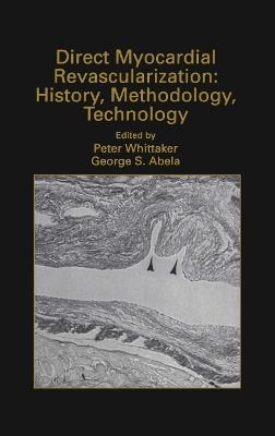 Direct Myocardial Revascularization: History, Methodology, Technology - cover
