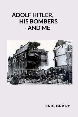 ibs