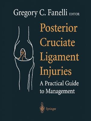 Posterior Cruciate Ligament Injuries: A Practical Guide to Management - cover