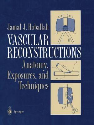 Vascular Reconstructions: Anatomy, Exposures and Techniques - Jamal J. Hoballah - cover