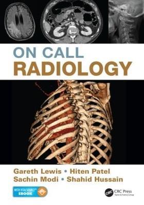 On Call Radiology - Gareth Lewis,Sachin Modi,Hiten Patel - cover