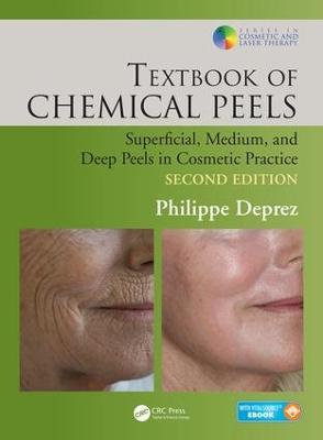 Textbook of Chemical Peels: Superficial, Medium, and Deep Peels in Cosmetic Practice - Philippe Deprez - cover