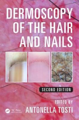Dermoscopy of the Hair and Nails - cover