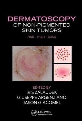 Dermatoscopy of Non-Pigmented Skin Tumors: Pink - Think - Blink - cover