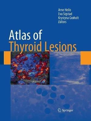 Atlas of Thyroid Lesions - cover