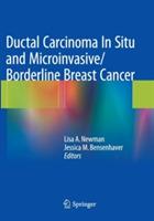 Ductal Carcinoma In Situ and Microinvasive/Borderline Breast Cancer - cover