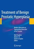 Treatment of Benign Prostatic Hyperplasia: Modern Alternative to Transurethral Resection of the Prostate - cover