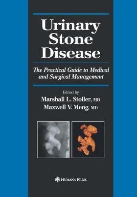 Urinary Stone Disease: The Practical Guide to Medical and Surgical Management - cover