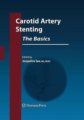 Carotid Artery Stenting: The Basics - cover