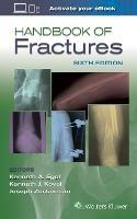 Handbook of Fractures - cover