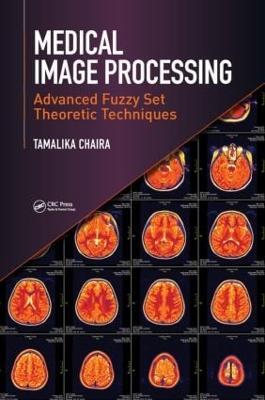 Medical Image Processing: Advanced Fuzzy Set Theoretic Techniques - Tamalika Chaira - cover