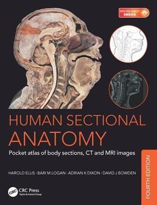 Human Sectional Anatomy: Pocket atlas of body sections, CT and MRI images, Fourth edition - Adrian Kendal Dixon,David J. Bowden,Bari M. Logan - cover