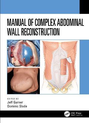 Manual of Complex Abdominal Wall Reconstruction - cover