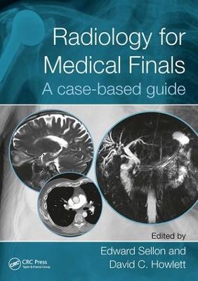 Radiology for Medical Finals: A case-based guide - cover