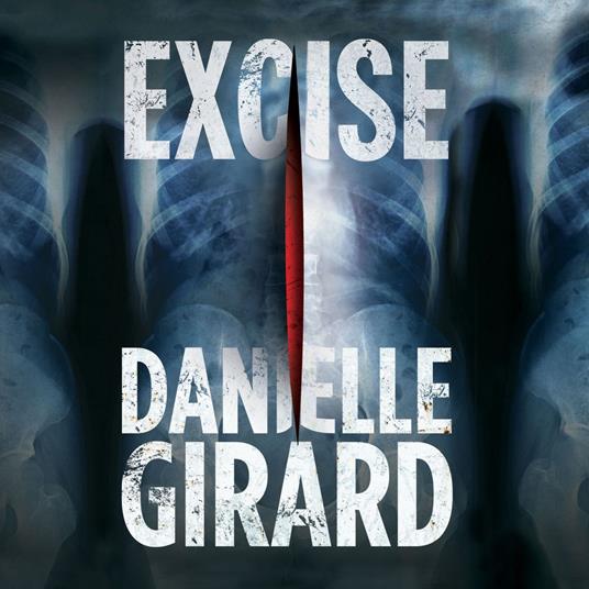 Excise