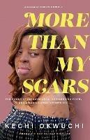 More Than My Scars - The Power of Perseverance, Unrelenting Faith, and Deciding What Defines You - Kechi Okwuchi,Simon Cowell - cover