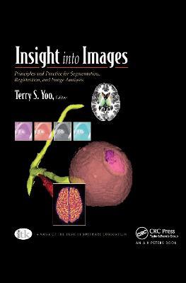 Insight into Images: Principles and Practice for Segmentation, Registration, and Image Analysis - cover